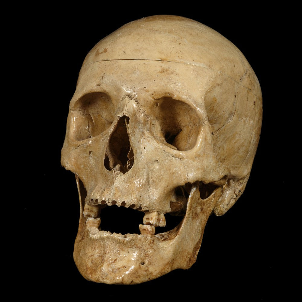 MEDICAL STUDY HUMAN SKULL - RELICS