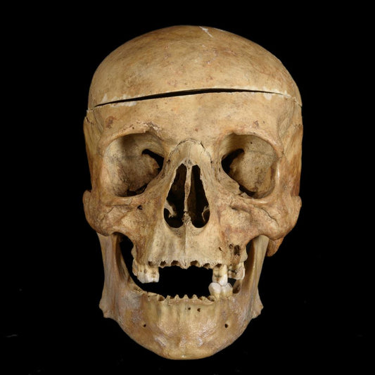 MEDICAL SKULL - RELICS