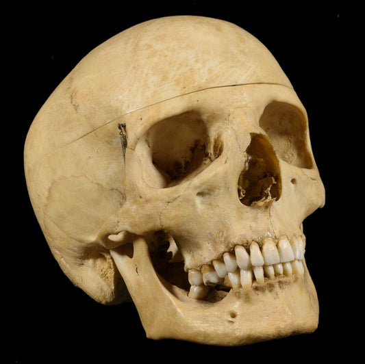 MEDICAL TEACHING SKULL WITH THREE VERTEBRAE - RELICS