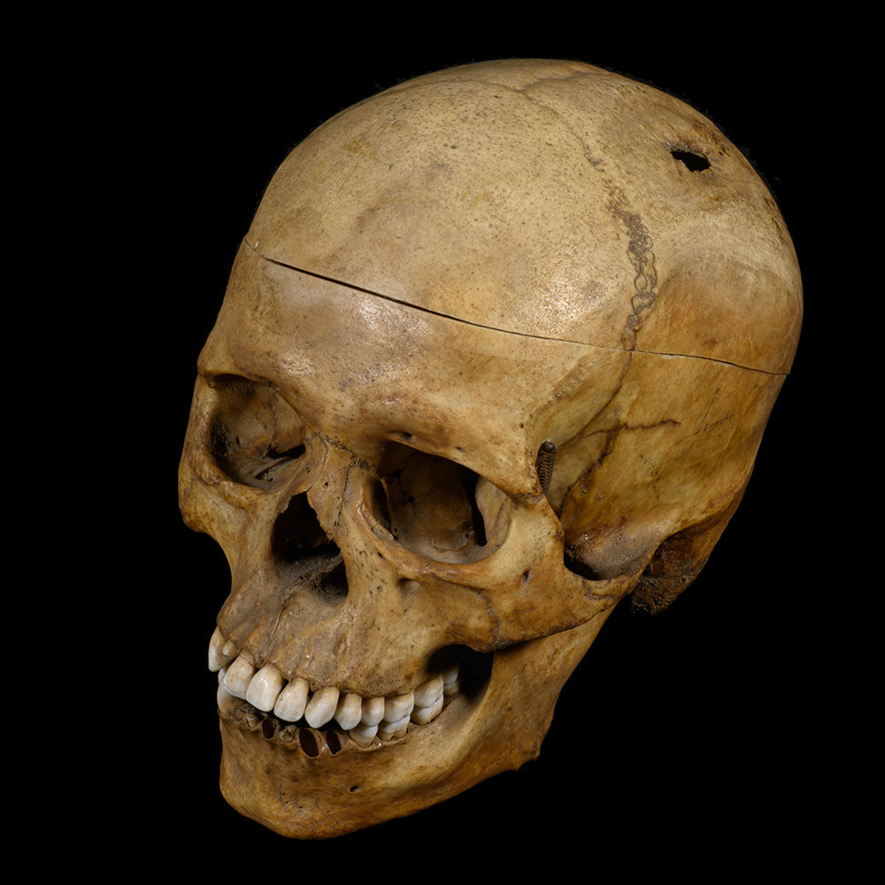 TREPANED HUMAN SKULL - RELICS - ODDITIES 